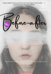 Before-After