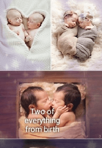 Two of everything from birth